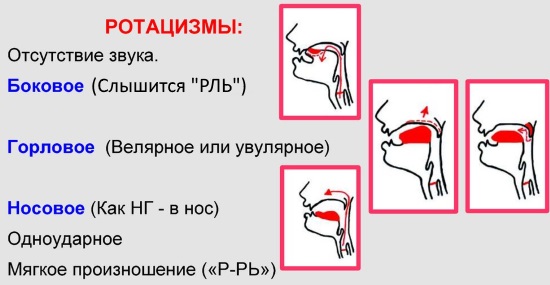 Постановка р при горловом произношении презентация