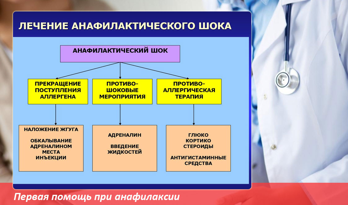 Анафилактический шок причины клиническая картина неотложная помощь